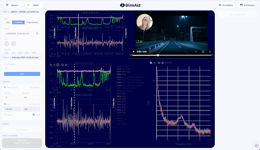 BlinkAid EMG annotation dashboard with real-time signal traces and driving simulator video